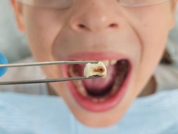 Best Emergency Broken Tooth Repair in Somerdale, NJ